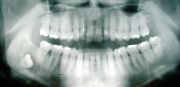 К чему снятся зубы